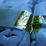 The implant has a substrate of silk that supports the mesh of electrodes.