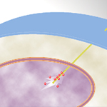 A nanoneedle that releases quantum dots directly into the nucleus of a living cell when a small electrical charge is applied. The quantum dots are tracked to gain information about conditions inside the nucleus.