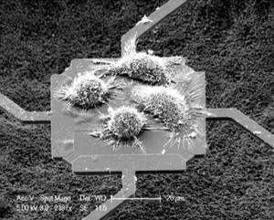 A scanning electron microscope image of cells growing on a microsensor. The researchers were able to measure the increase in mass as they watched a cell grow and divide into four cells.