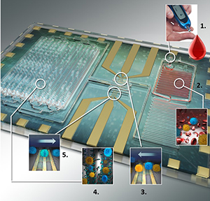 Differential immuno-capture biochip offers accurate, specific leukocyte ...