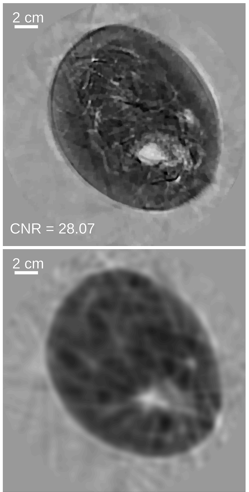 Sound speed images of a breast cancer patient reconstructed by use of (top) a waveform inversion method and (bottom) a conventional bent-ray method.